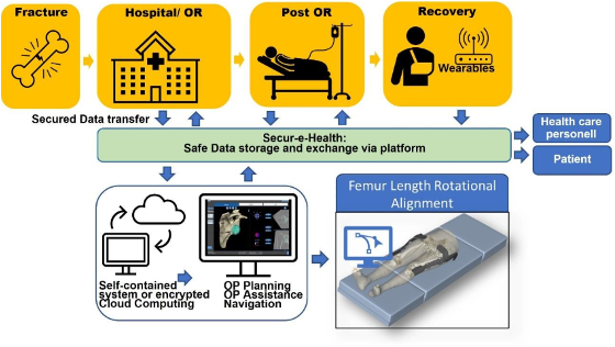 Smart Fracture Care